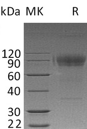Recombinant Human IL-2RG (C-Fc)