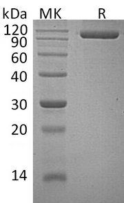 Recombinant Human SEMA4G (C-6His)