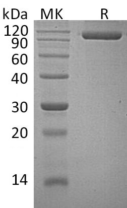 Recombinant Human SEMA4G (C-6His)