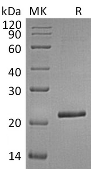Recombinant Human TIMP-4 (C-6His)