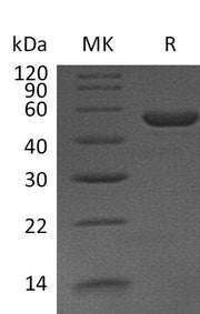 Recombinant Mouse IL-11 (C-Fc)