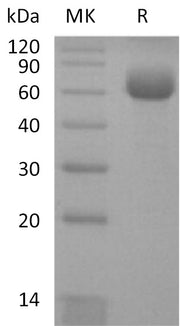 Recombinant Human CD161 (C-Fc)