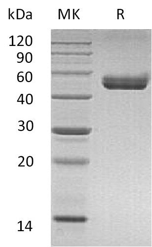Recombinant Mouse CD74 (C-mFc-6His)