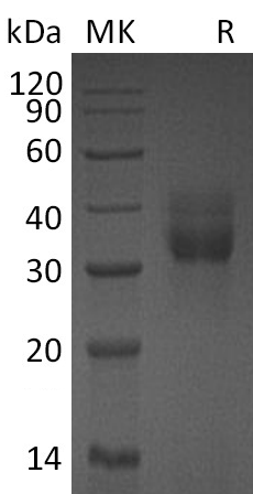 Recombinant Mouse CTSB (C-6His)