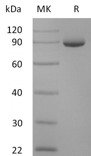 Recombinant Human Periostin (C-6His)