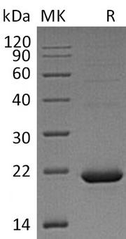 Recombinant Human CYB5B (C-6His)