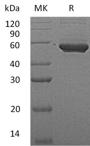 Recombinant Human PIP4K2A (C-6His)