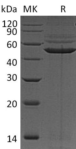 Recombinant Human PRKAR1A (C-6His)