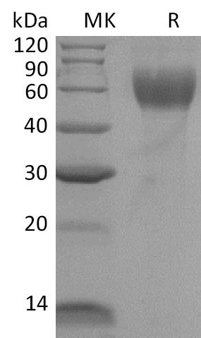 Recombinant Mouse IL-1R1 (C-6His)