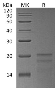 Recombinant Human ZNHIT1 (N-6His)