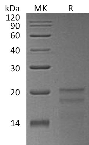 Recombinant Human ZNHIT1 (N-6His)