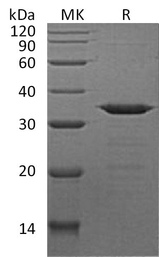 Recombinant Human NECAP2 (N, C-6His)