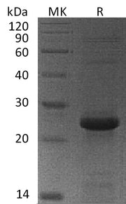Recombinant Human MGMT (N-6His)