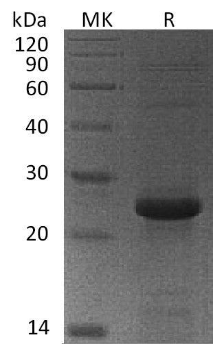 Recombinant Human MGMT (N-6His)