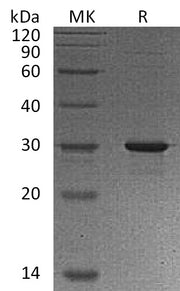 Recombinant Human GAMT (N, C-6His)