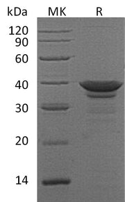 Recombinant Human ARG1 (C-6His)