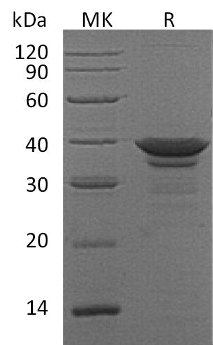 Recombinant Human ARG1 (C-6His)