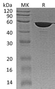 Recombinant Human FKBP4 (C-6His)