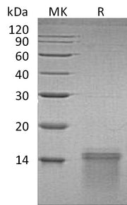 Recombinant Human UCMA