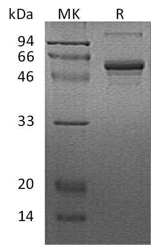 Recombinant Human CSNK1G2 (N-6His)