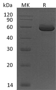Recombinant Human PEPD