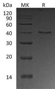 Recombinant Human UPRT (N-6His)