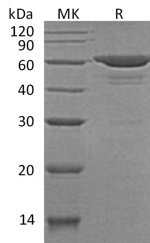 Recombinant Human ACAT2 (N-Trx-6His)