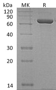 Recombinant Human CPNE1 (N, C-6His)