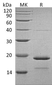 Recombinant Human HSPB7 (C-6His)