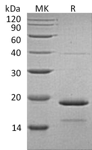 Recombinant Human HSPB7 (C-6His)