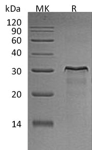 Recombinant Rat HER2 (C-6His)