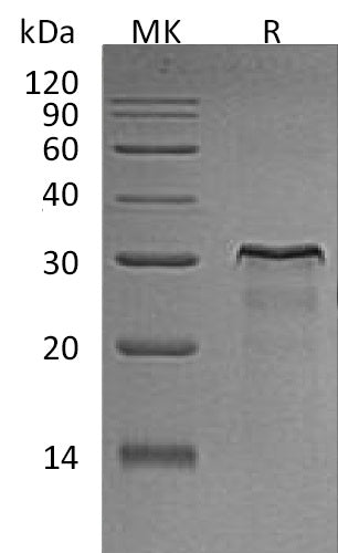 Recombinant Rat HER2 (C-6His)