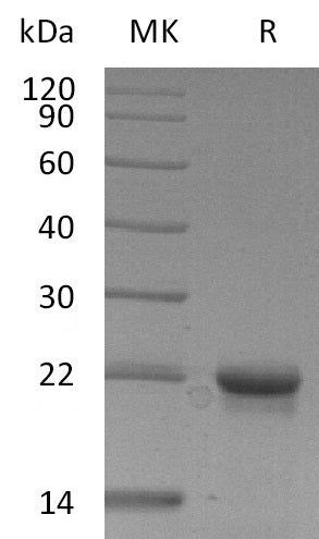 Recombinant Human EIF5A2 (N-6His)