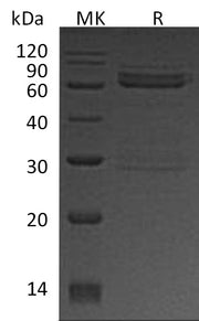 Recombinant Human CAMK1D (N-GST)