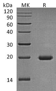 Recombinant Human IL-17D