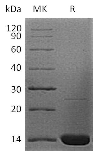 Recombinant Human B2M (N-6His)