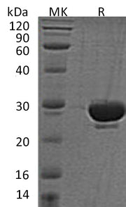 Recombinant Human SENP2