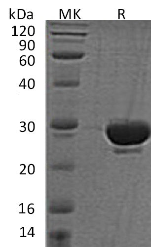 Recombinant Human SENP2