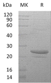 Recombinant Human CT-1 (N-6His)