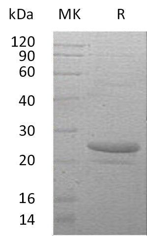 Recombinant Human CT-1 (N-6His)