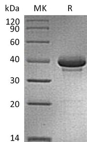 Recombinant Human CALCB (C-Fc)