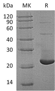 Recombinant Human TMX2 (N-6His)