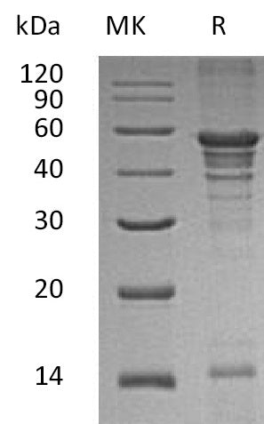 Recombinant Human UBA5 (N-6His)