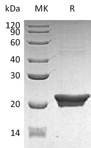 Recombinant Human NGAL (C-6His, E. coli)