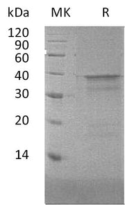 Recombinant Human NFYA