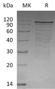 Recombinant Rat PSD-95 (N-6His)