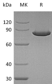 Recombinant Human Ezrin