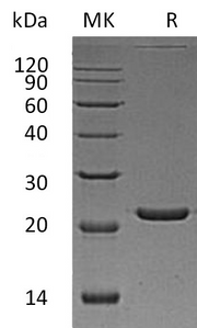 Recombinant Human FTL (N-6His)