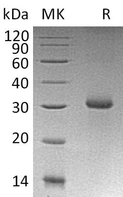Recombinant Human RGMA (N-6His)