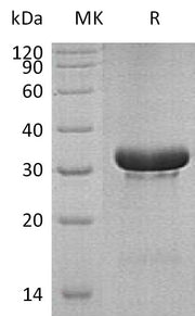 Recombinant Human TRIM5 (N-6His)